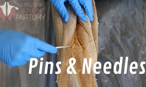 What Are “Pins & Needles”?
