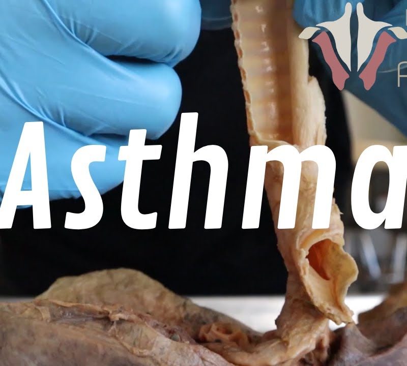 What Is Asthma, and How Is it Treated? | A Deep Look Into Respiratory Disease