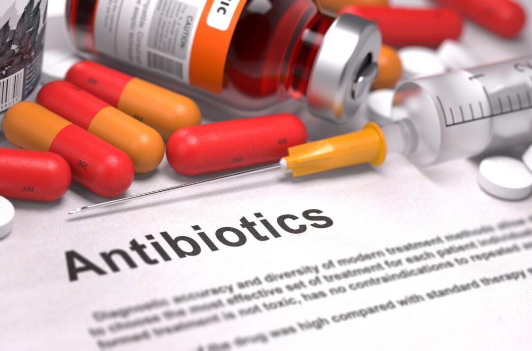 Do I need antibiotics?