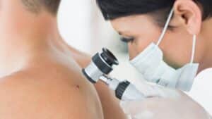 How can I prevent skin cancer?