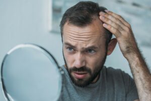 Is there a treatment for hair loss?