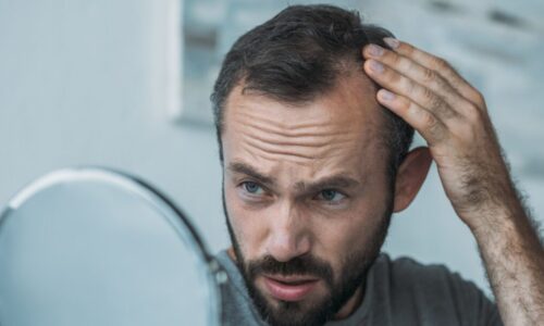 Is there a treatment for hair loss?