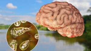 What and where are brain-eating amoebas?