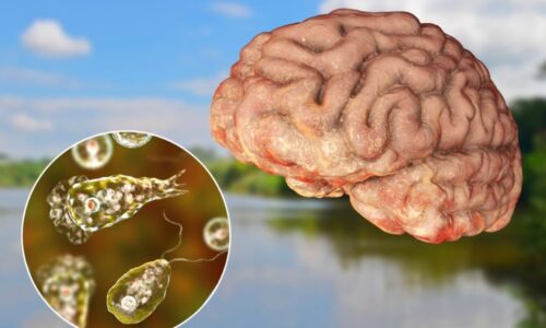What and where are brain-eating amoebas?