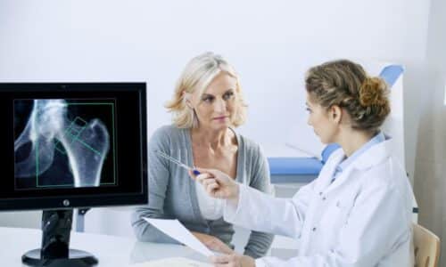 What are the risk factors and complications of osteoporosis?