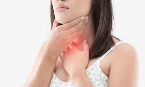 What do I need to know about swollen lymph nodes?
