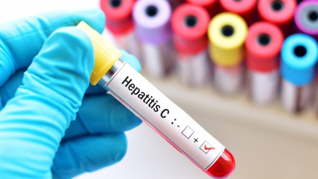 Hepatitis C