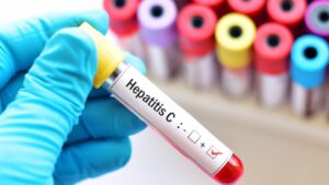 What is Hepatitis C?