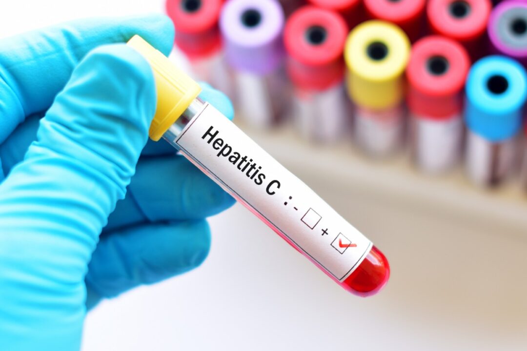 What is Hepatitis C?