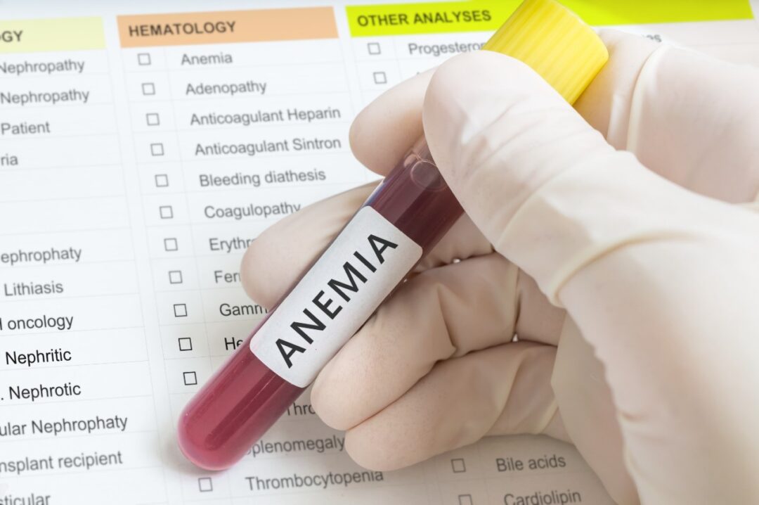 What is anemia?, Health Channel