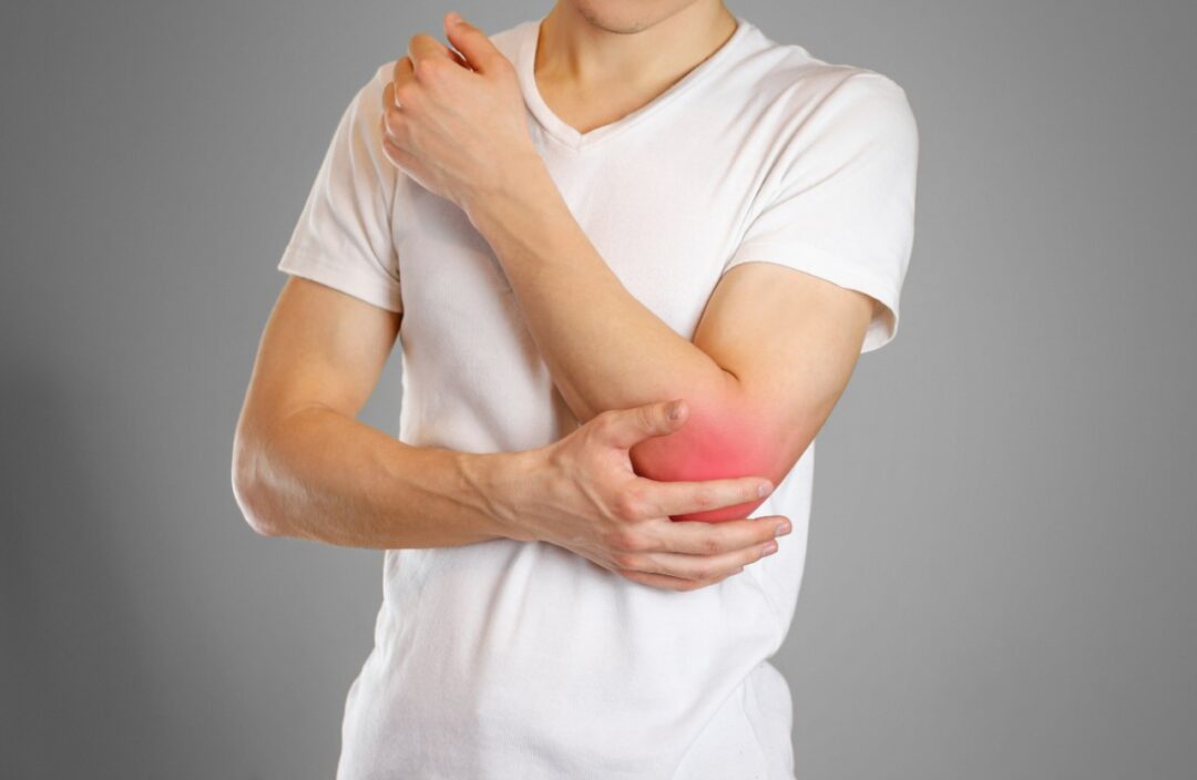 What is bursitis?