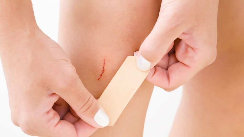 What is the best way to treat a small cut or wound?