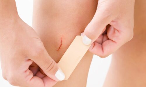 What is the best way to treat a small cut or wound?