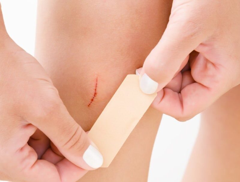 What is the best way to treat a small cut or wound?