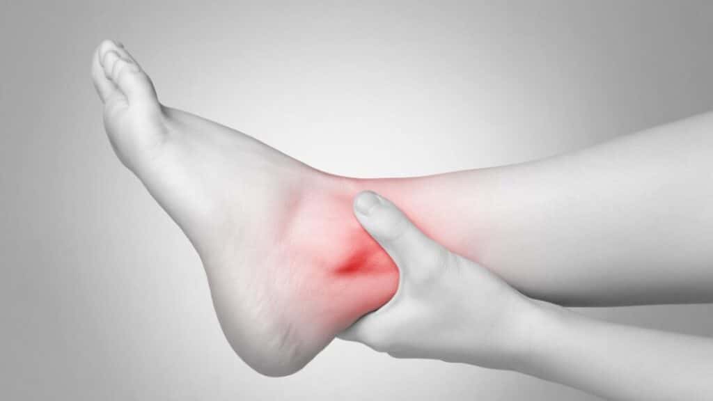 How do I take care of an ankle sprain?