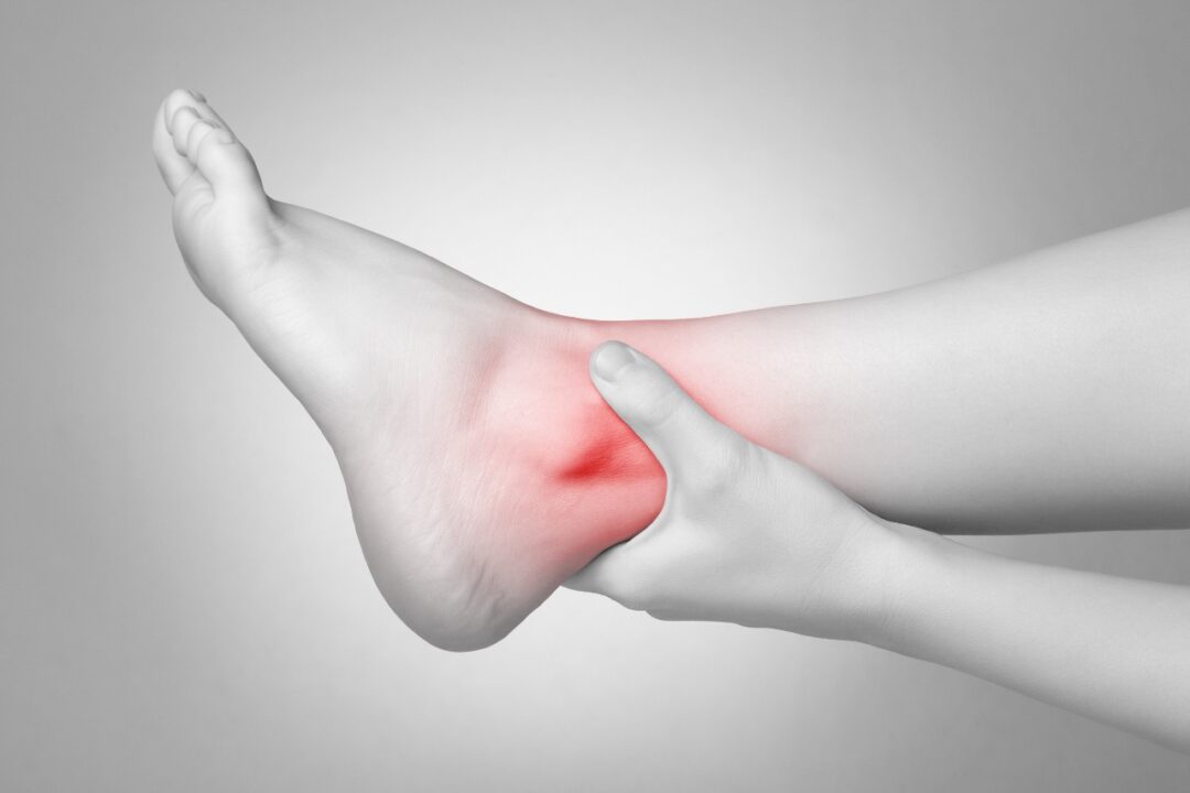 How do I take care of an ankle sprain?