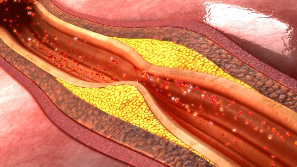 In reality, how bad is cholesterol?