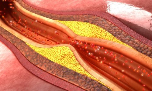 In reality, how bad is cholesterol?