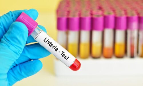 Is listeria a real concern?