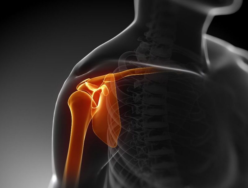 What causes my shoulder pain?