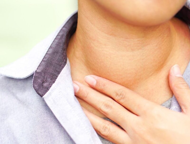 What is a goiter and what do you do about it?