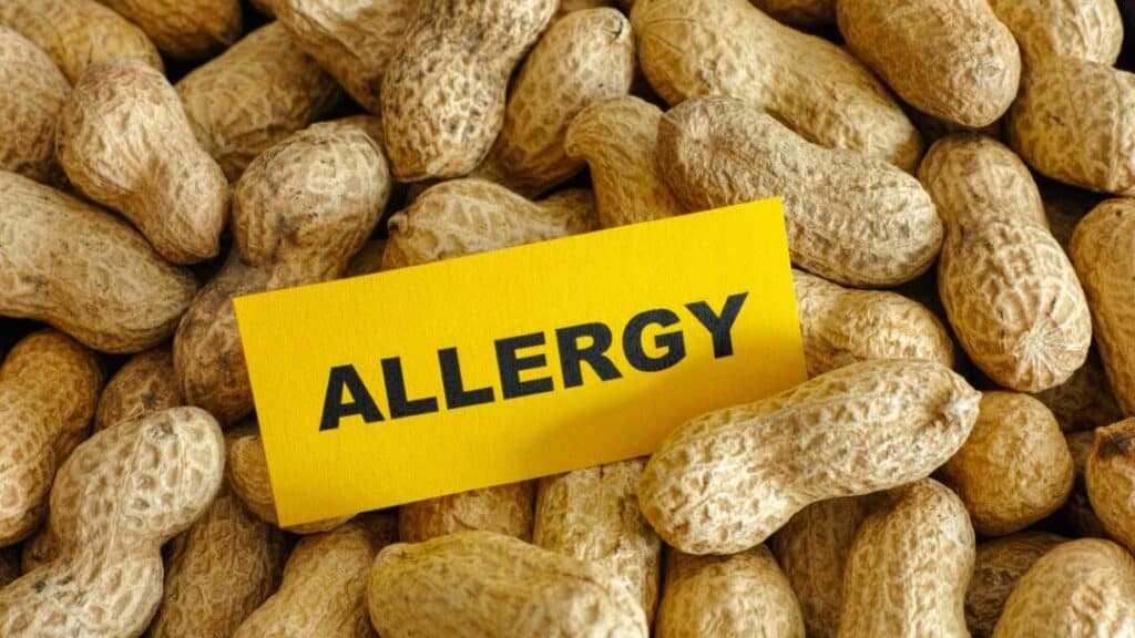 What is a peanut allergy?