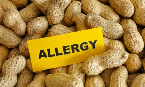 What is a peanut allergy?