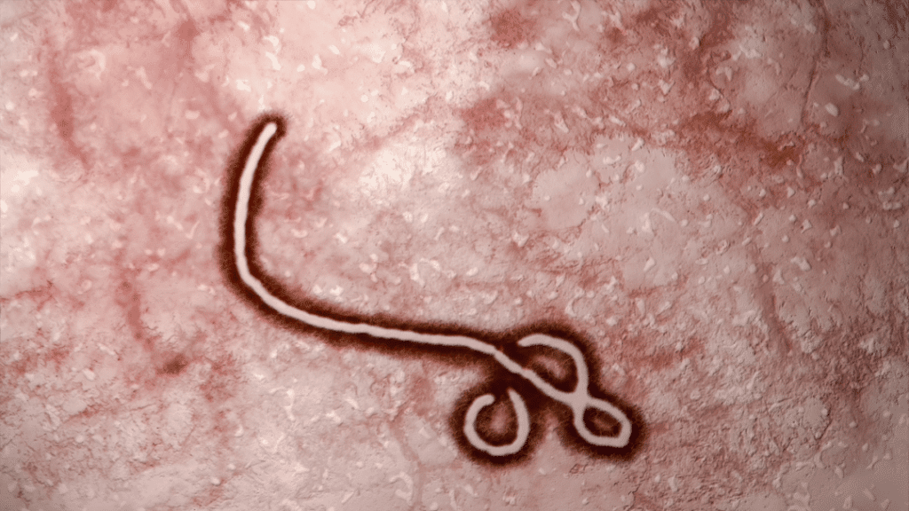 What is supportive care in relation to Ebola infections?