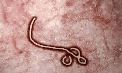What is supportive care in relation to Ebola infections?