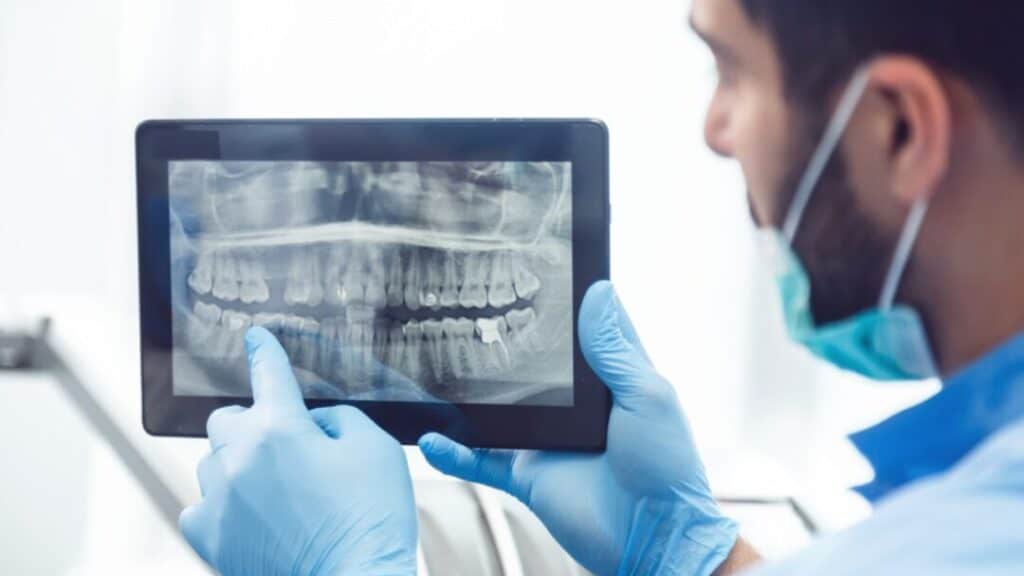 Why do we need dental x-rays and how often should they be done?