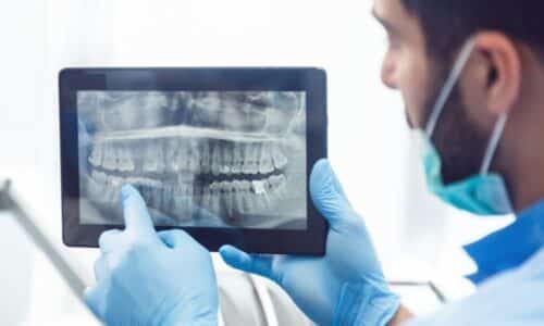 Why do we need dental x-rays and how often should they be done?