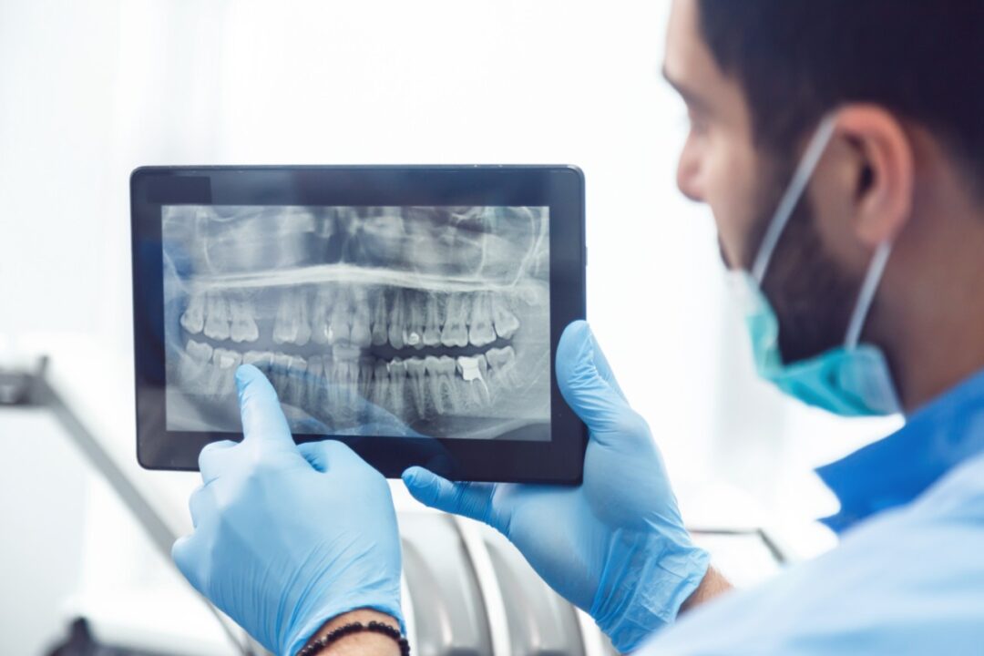 Why do we need dental x-rays and how often should they be done?