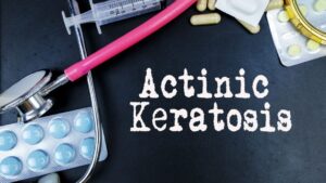 What is Actinic Keratoses?