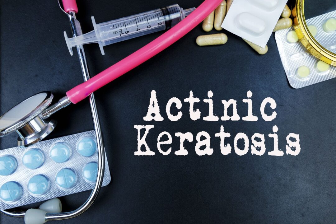 What is Actinic Keratoses?
