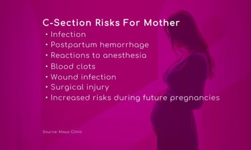 C-Section Risks for Mother & Baby