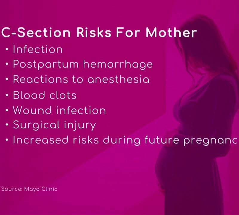 C-Section Risks for Mother & Baby