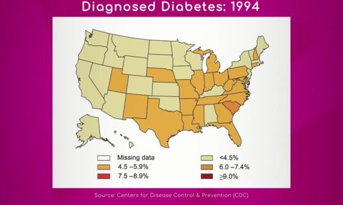 Vascular Diseases: Diabetes