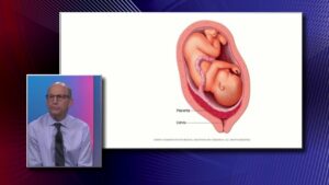 Risk Factors of Placenta Previa