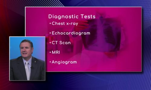 Diagnosing Aortic Aneurysm