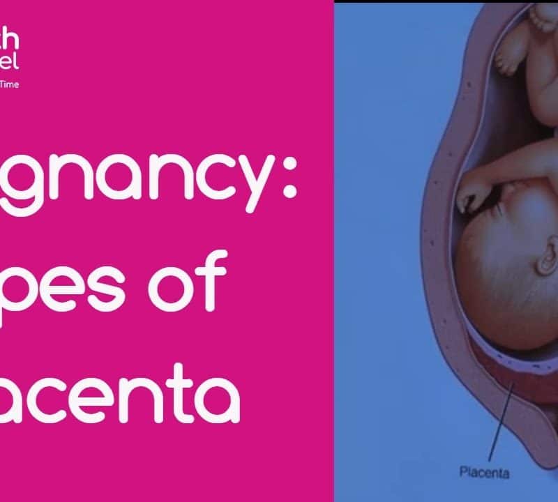 Pregnancy: Types of Placenta