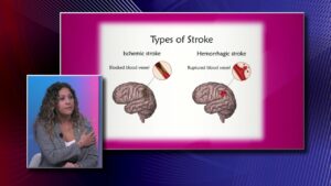 Brain Health: Strokes