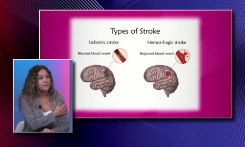 Brain Health: Strokes