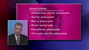 Types of Aneurysm