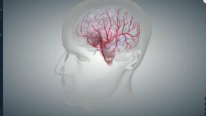 Anatomy of the Brain & Strokes
