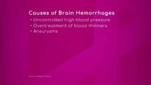 Causes of Brain Hemorrhages