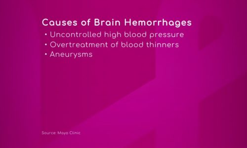 Causes of Brain Hemorrhages