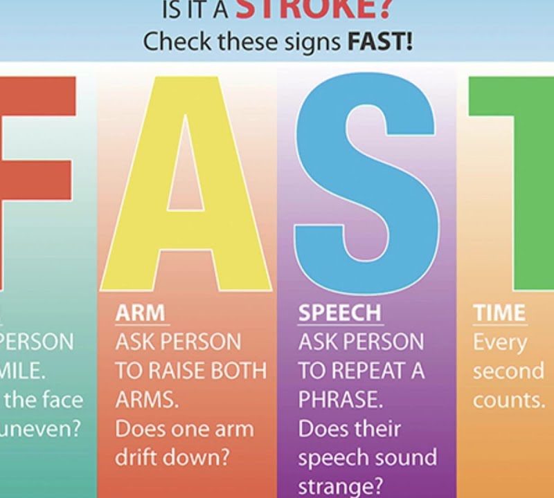 Diagnosis of a Stroke: FAST