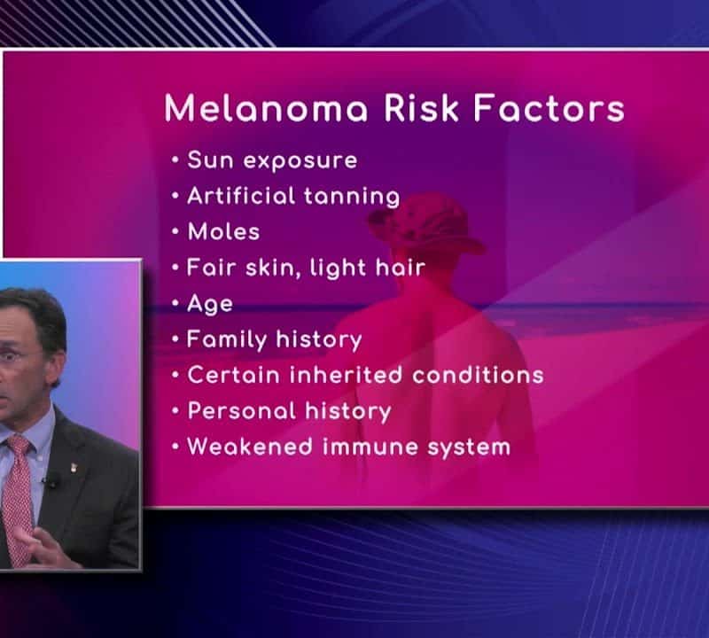 Risk Factors of Melanoma