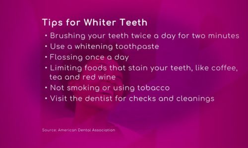 Teeth-Whitening Treatments