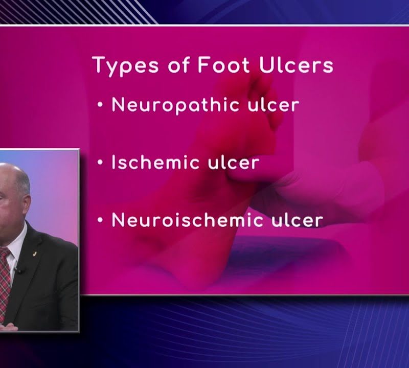 Types of Foot Ulcers